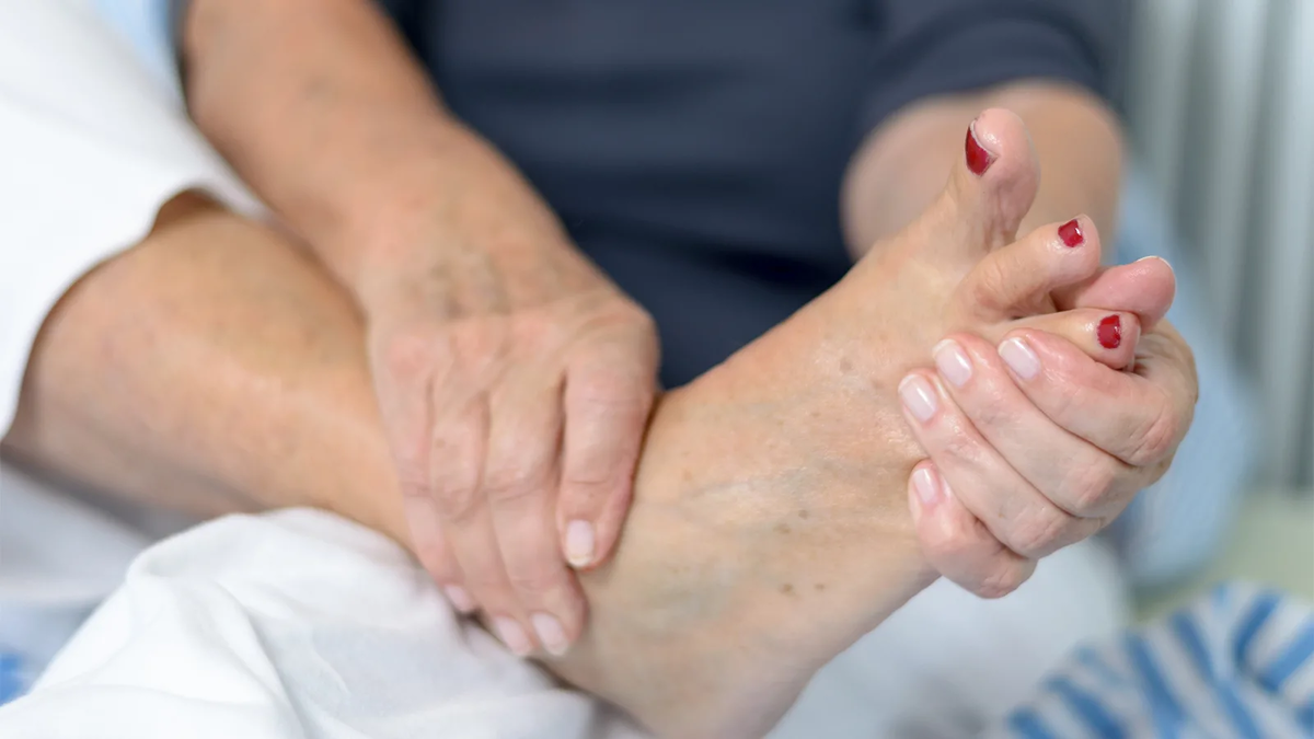 Лечебные мероприятия при диабетической стопе. Нейропатия нижних конечностей при сахарном диабете. Диабетическая стопа начальная стадия. Ступни ног. Упражнения при диабетической стопе.