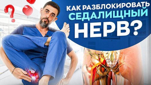 Как разблокировать седалищный нерв без боли! Ишиаса как не бывало