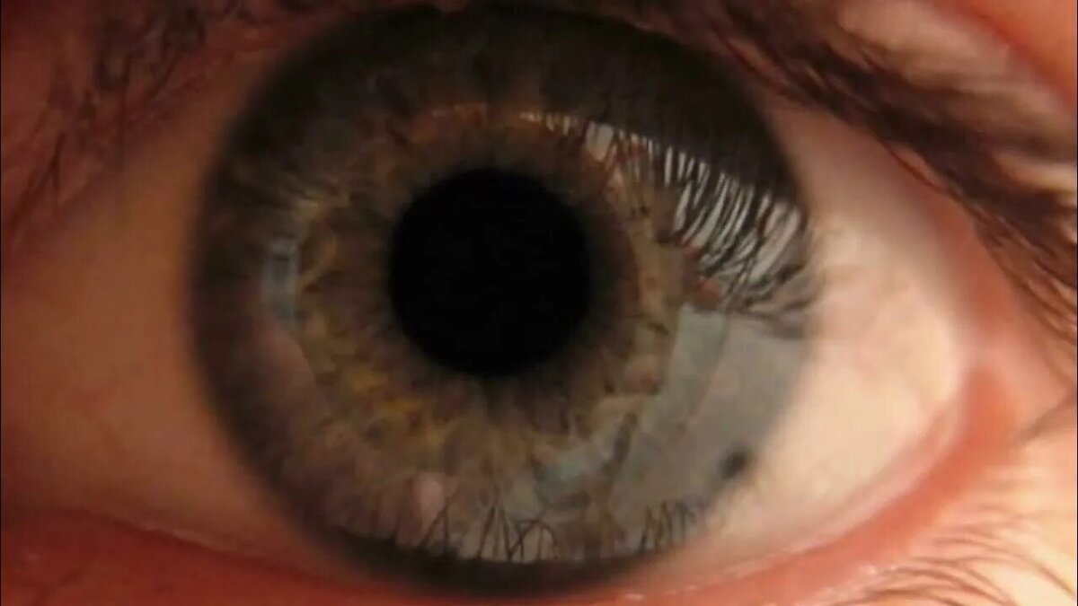 Прыгает картинка в глазах и шаткость при ходьбе- возможна общая причина 