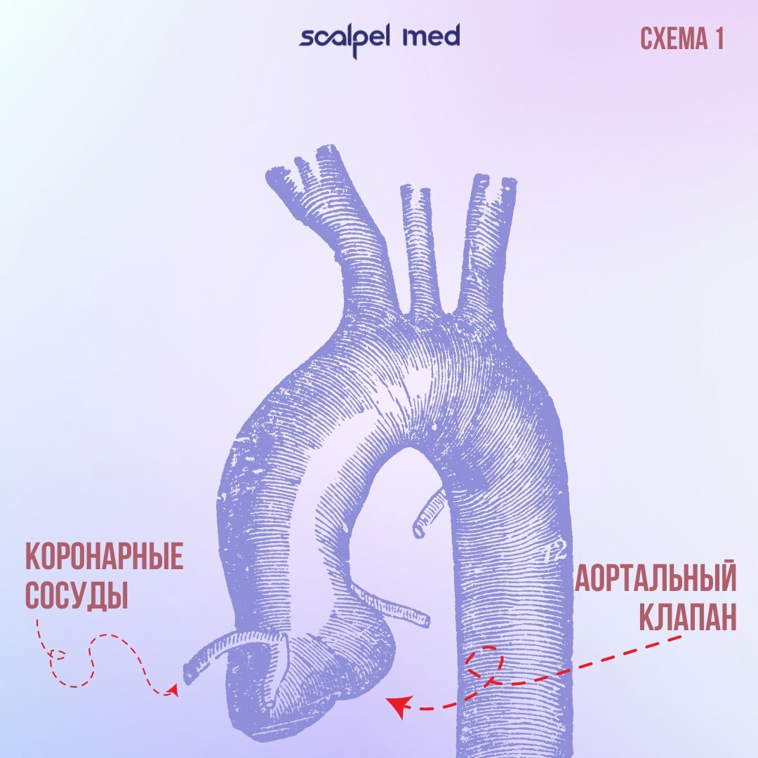 Операция Бенталла Де Боно