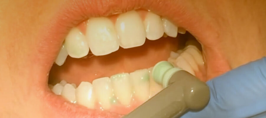 Пример поверхностной полировки