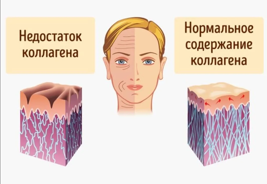 Чем опасен недостаток коллагена? Канал ТусоВО!чка. 