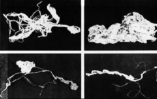 "Волосы ангела"