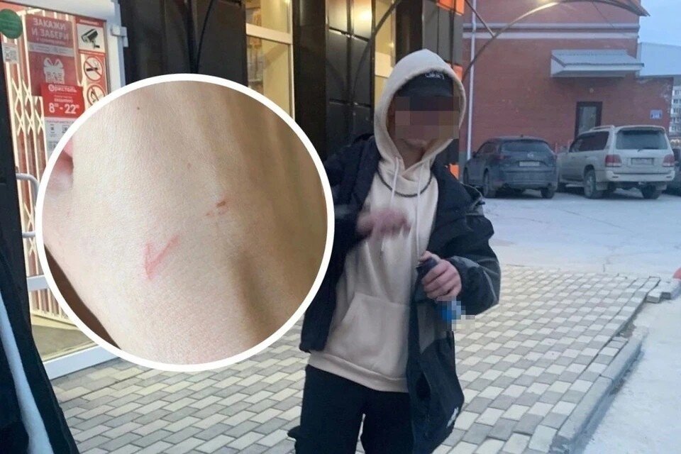     Подростки напали на девушку. Фото: предоставлено Екатериной