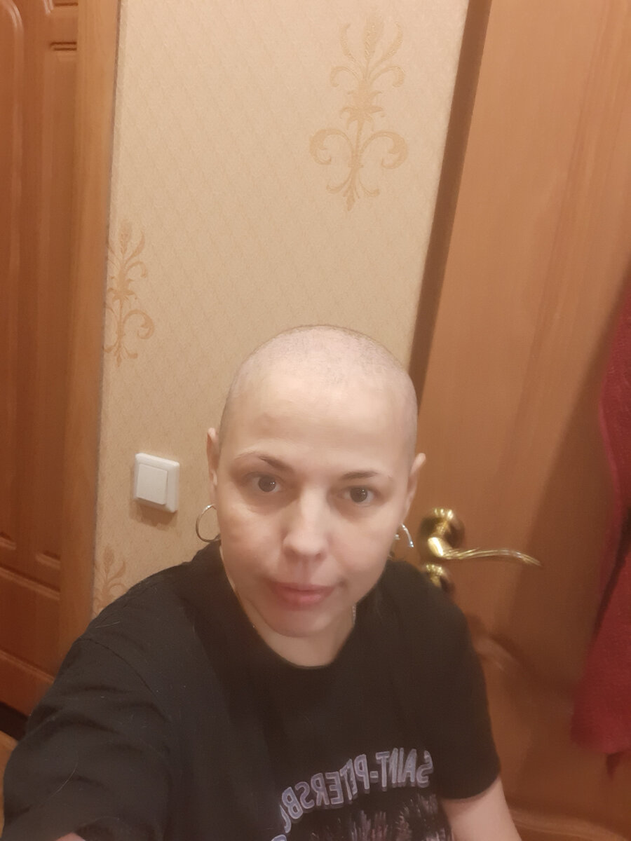Приехала домой и муж побрил меня сразу. 11.04.2020 год. Страшная, просто жесть. Фото из личного архива.