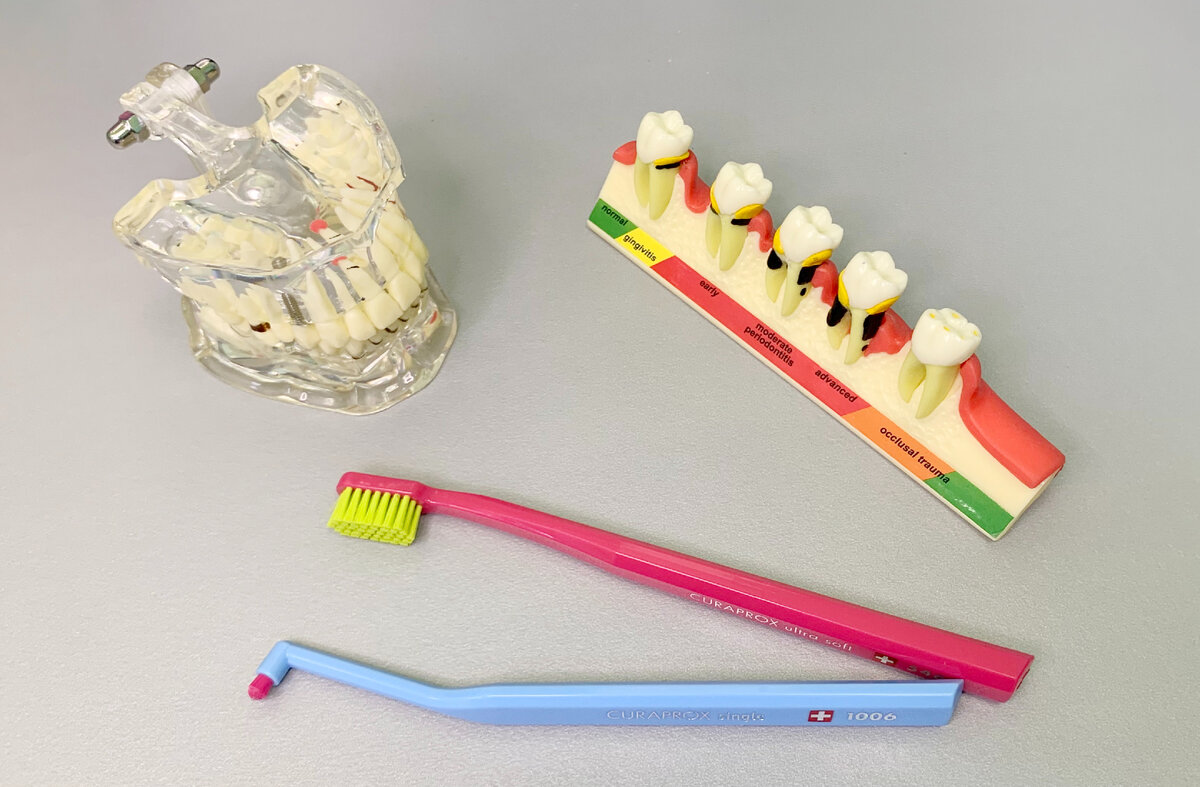 Выбираем зубную щетку вместе со стоматологом