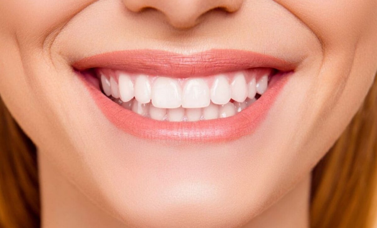 Виды улыбок в стоматологии фото и названия