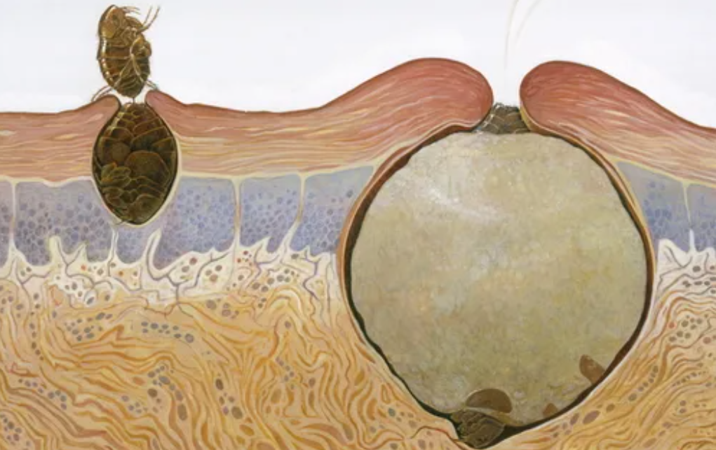 Как разбухает со временем проникающая блоха