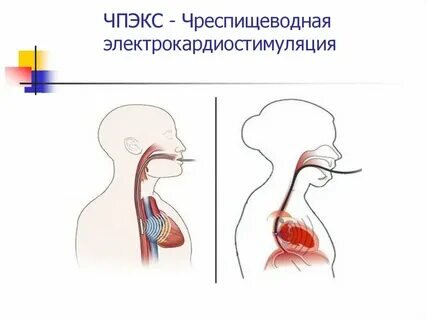 изображения взято в Яндекс картинках