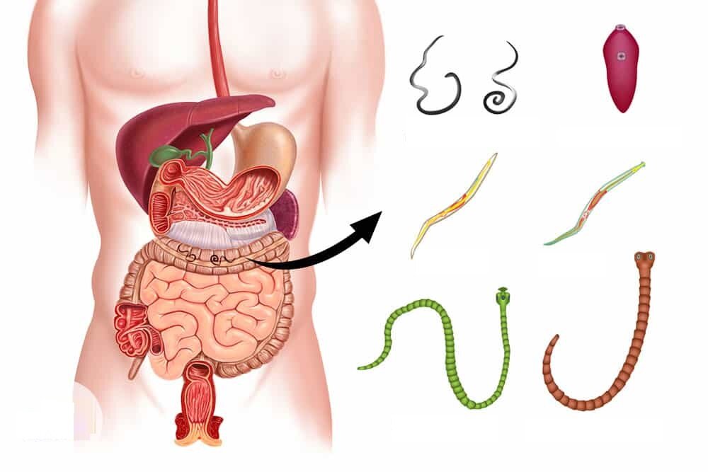 Паразиты в организме картинка