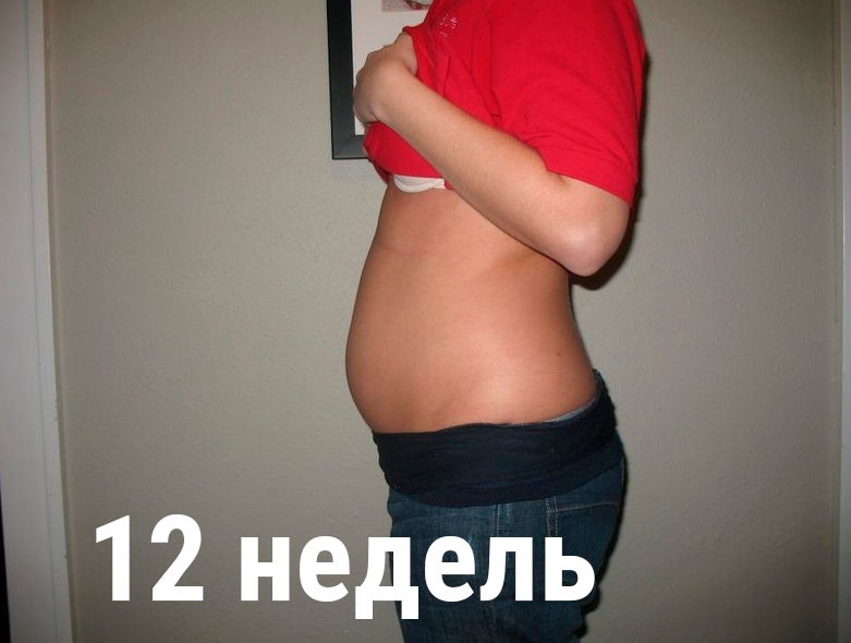 12-я неделя беременности