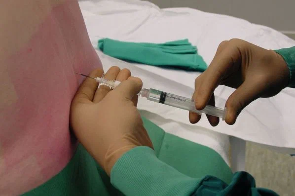 Трагедия после спинномозговой анестезии