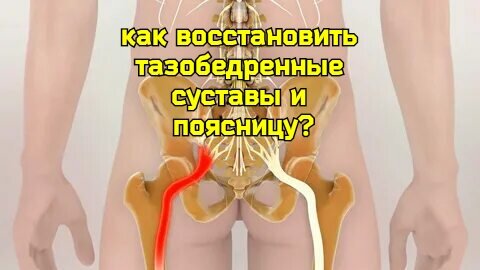 Страдаете от проблем с тазобедренными суставами и поясницей? Укрепите их с помощью осевого вытягивания