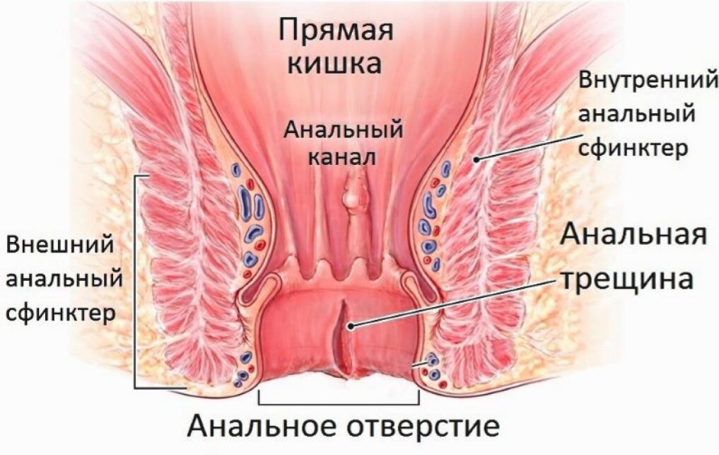 Трещины заднего прохода презентация