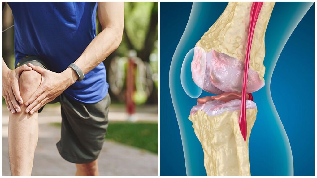 При хождении болит колено. Смещение коленного сустава. Болит коленка при ходьбе причины. Болит коленка при ходьбе причины. Боль в суставах.