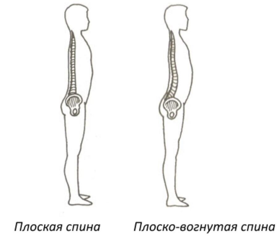 Прямой позвоночник без изгибов