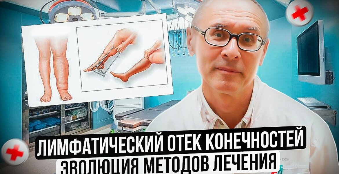 Лимфатический отек конечностей - эволюция методов лечения | Клиника ...