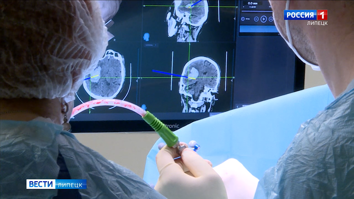 Сверхточные операции на головном мозге в Липецке стали проводить при помощи  нейронавигации | Вести Липецк | Дзен