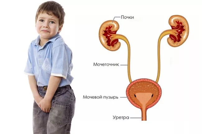 Цистит у детей: причины, симптомы, лечение