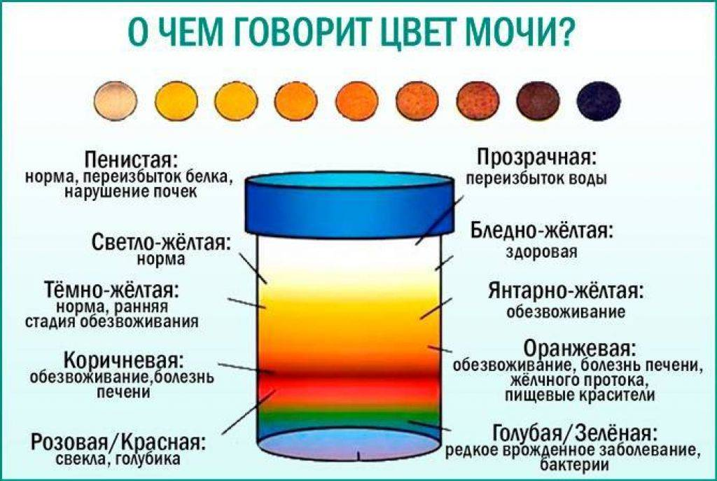 Цвет мочи. Темный цвет мочи. Изменение цвета мочи. Здоровый цвет мочи.