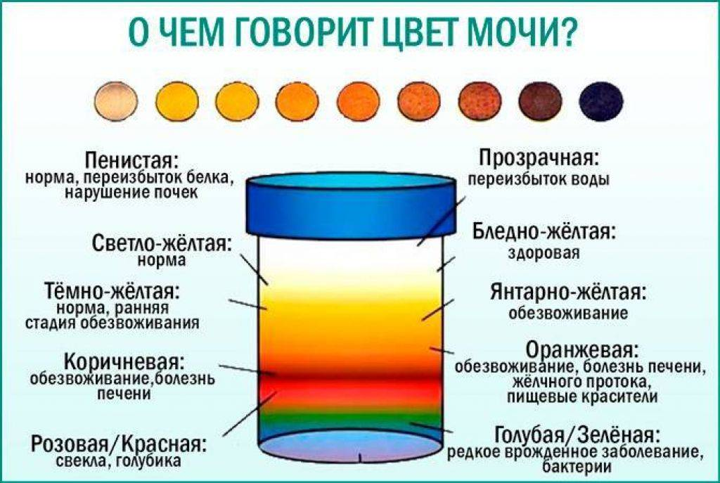 Какой нормальный цвет. Цвет мочи. Темный цвет мочи. Изменение цвета мочи. Здоровый цвет мочи.