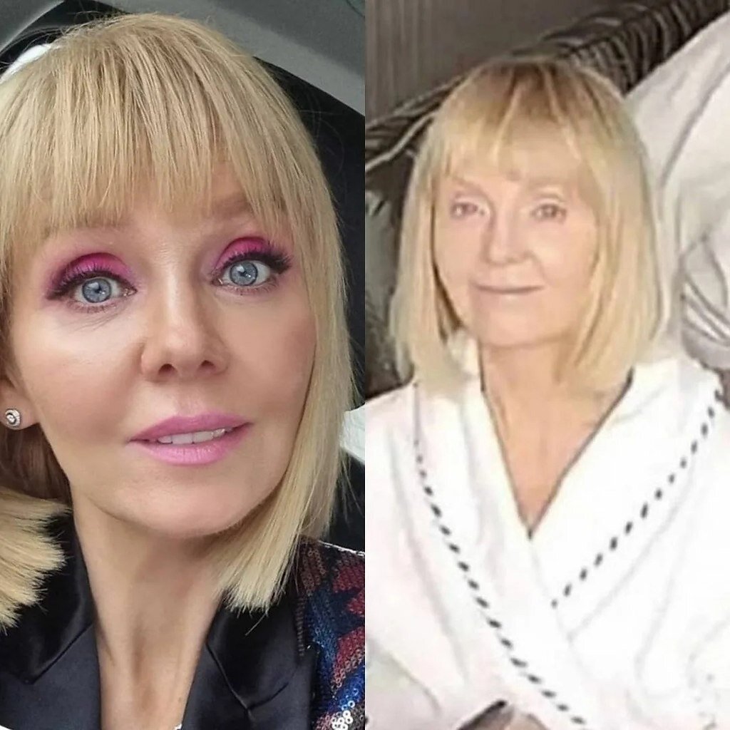 Фото певиц до и после