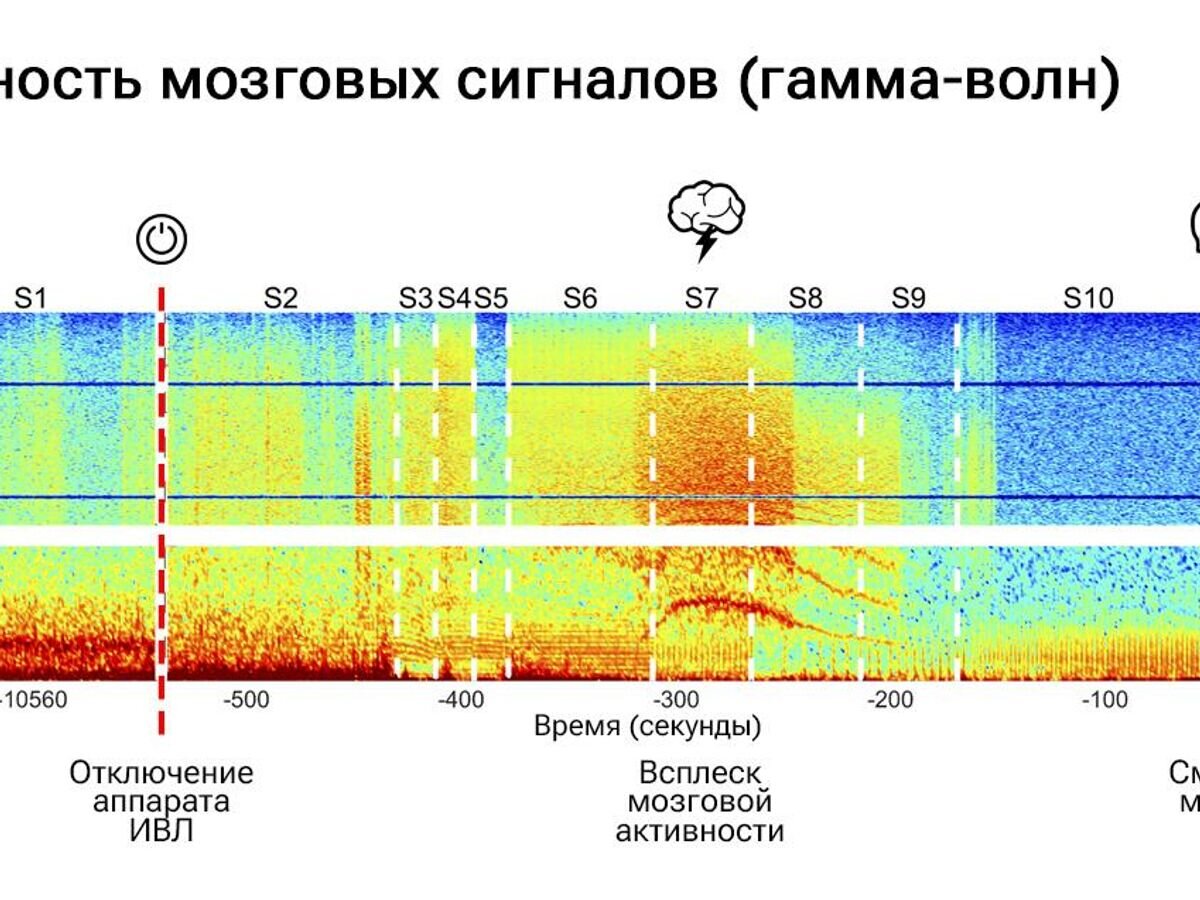    Активность мозговых сигналов (гамма-волн)CC BY 4.0 / Gang Xu et al., 2023 /