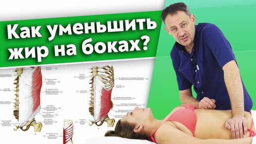 Проблемы с косыми мышцами живота. Как расположены косые мышцы живота?