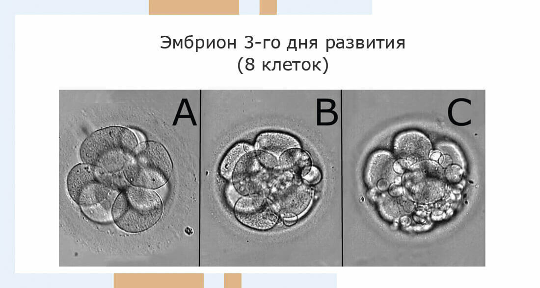 Эко эмбрионы по дням