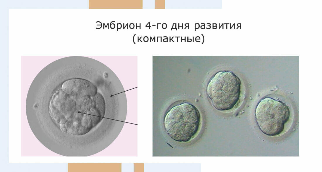 Эмбрионы 4 дня. Эмбрион на 4 день после оплодотворения. Эмбрион 7 дней после оплодотворения. Эмбрион 5 дней.