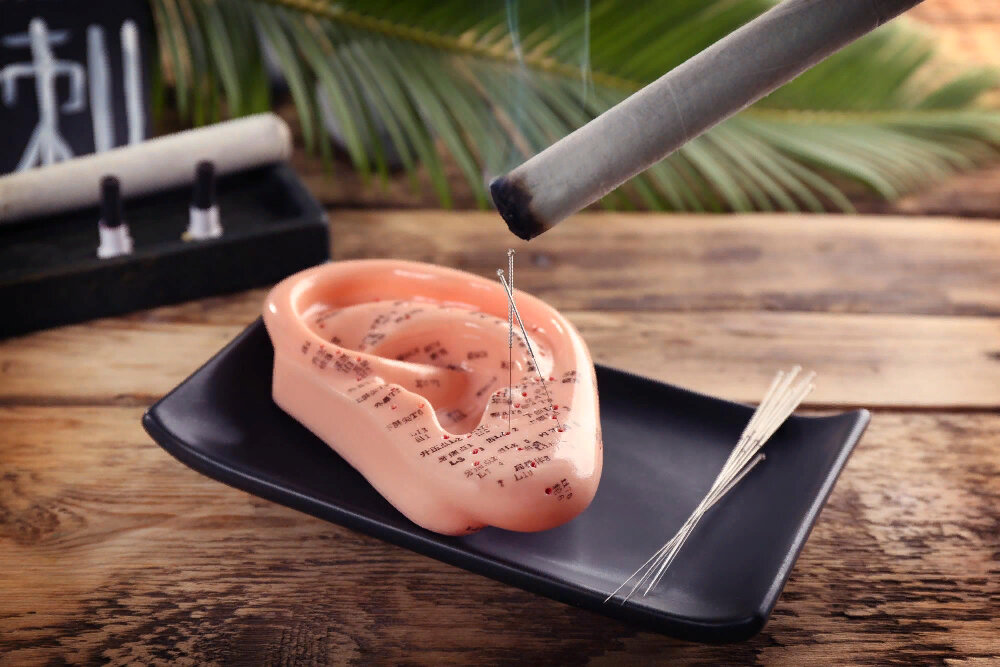 Можно ли избавиться от зависимости курения с помощью иглоукалывания? (Источник изображения: freepik.com)