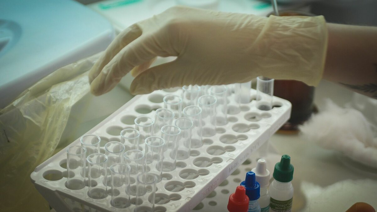     Три случая дирофиляриоза зарегистрировали в Нижегородской области в 2023 году. Эту информацию NewsNN подтвердили в областном управлении Роспотребнадзора.