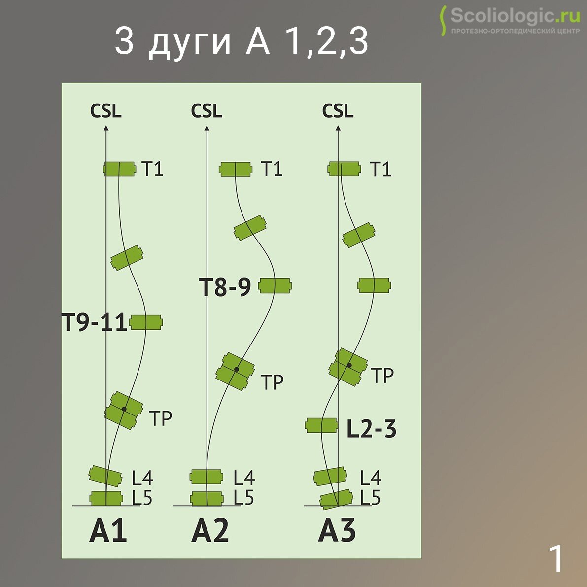 Сколиолоджик