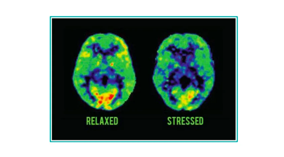 Мозг слева выдаёт более креативные идеи