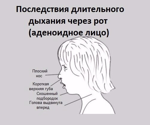 Ученые объяснили, почему важно дышать носом, а не ртом – Главное в Украине