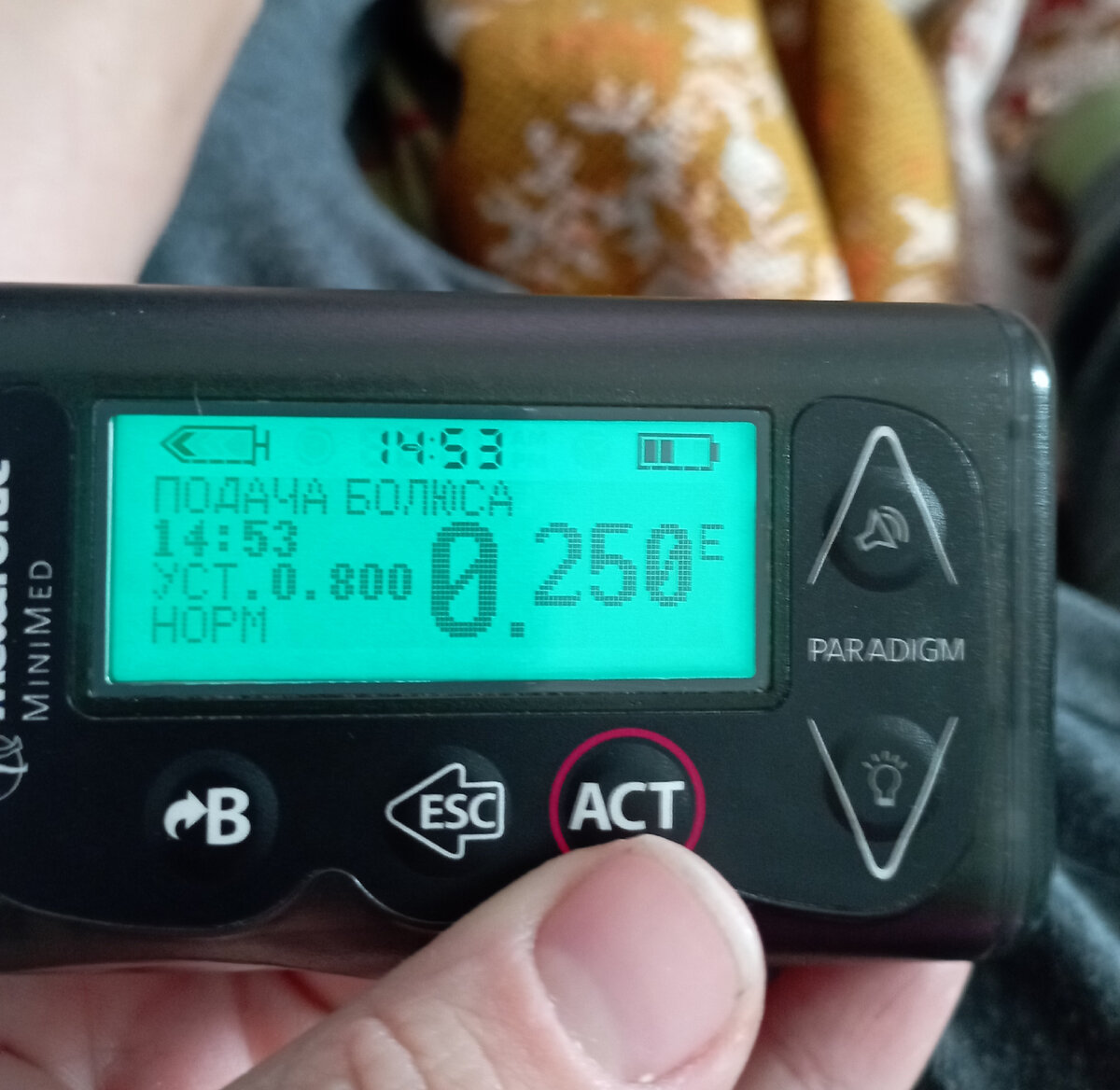 Вот он - чудо-прибор, в который заправлен инсулин. Он маленький, как 2 спичечных коробка. Помпа должна находиться рядом с диабетиком 24/7! Поскольку она беспрерывно подаёт гормон в тело человека без перерывов и выходных. 