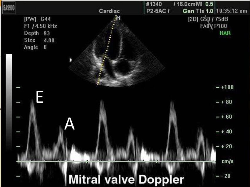 Все указанные в статье препараты рассматриваются только в ознакомительных целях. Перед применением проконсультируйтесь с врачом.