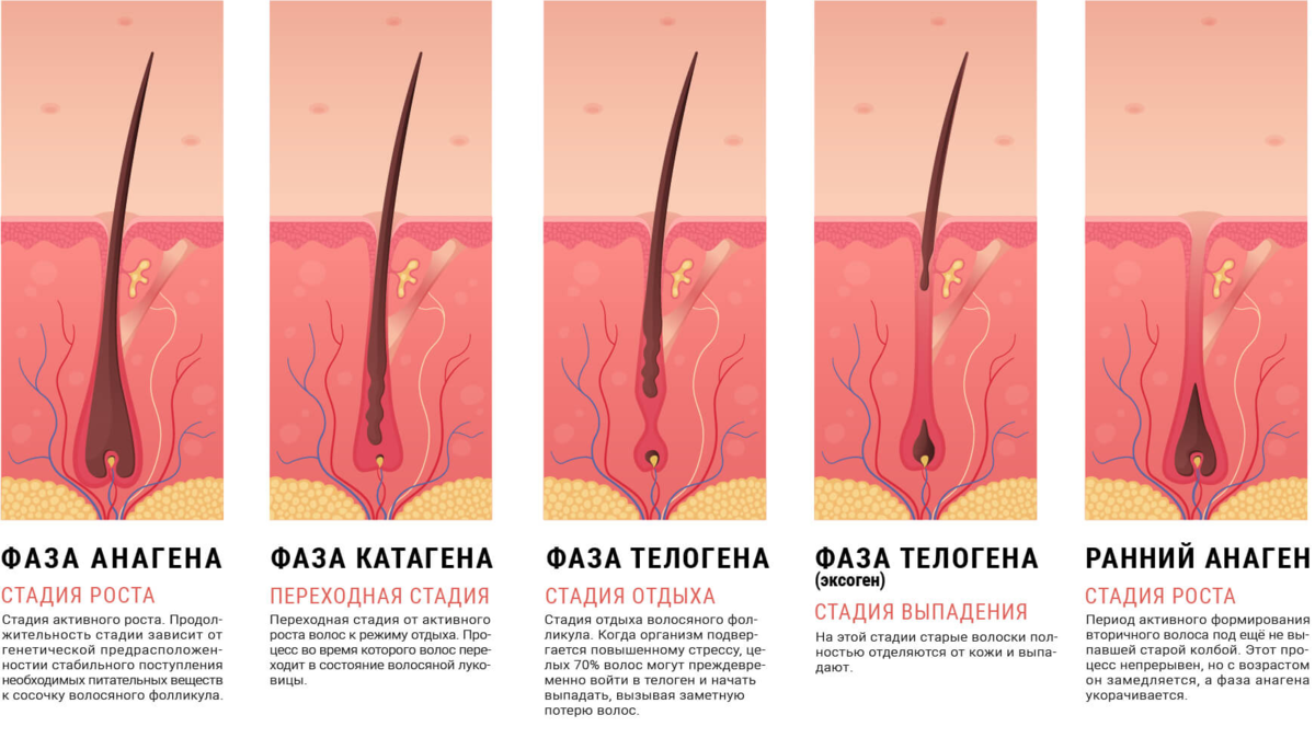 Андрогенетическая алопеция: почему выпадают волосы? | Dr. Матвей Ильин |  Дзен