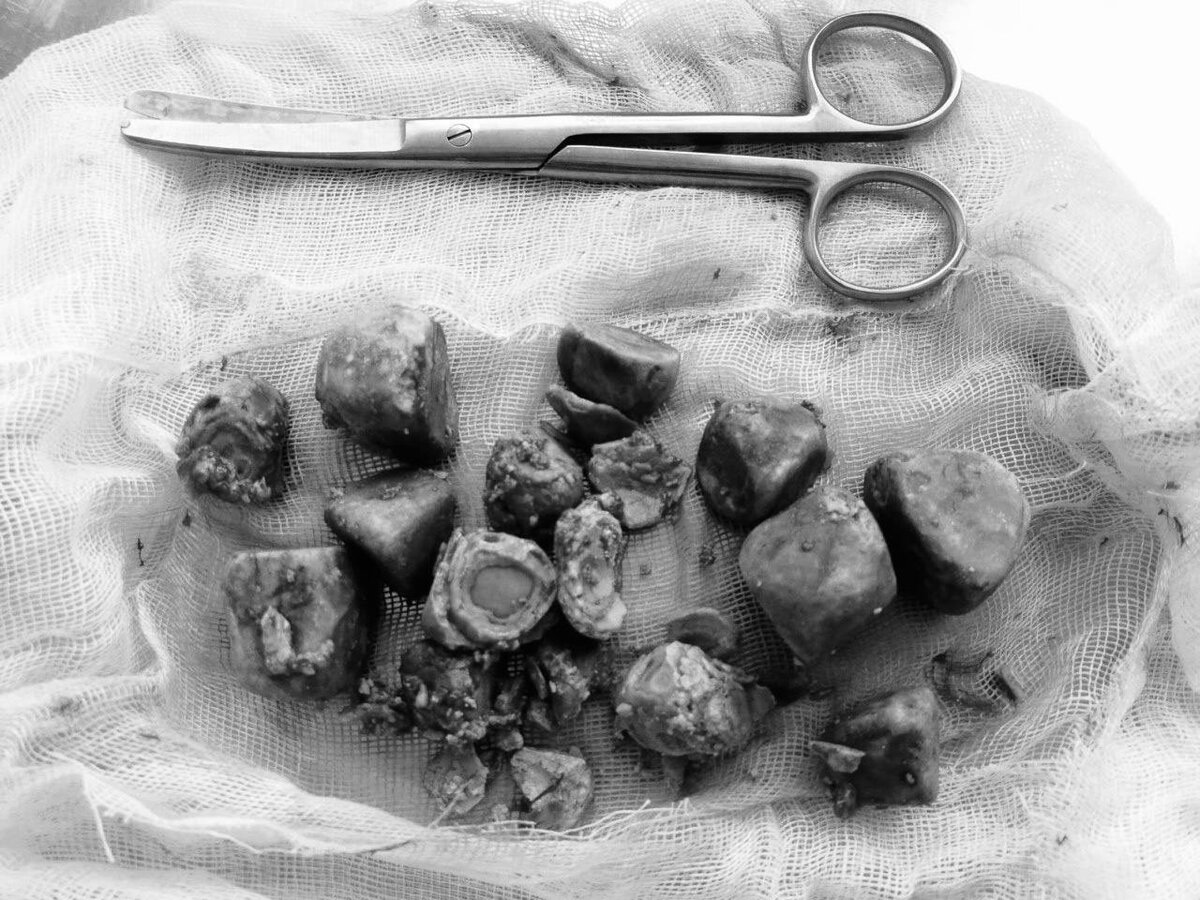 Врачи подмосковного Орехово-Зуевского округа спасли пациентку, которая ...