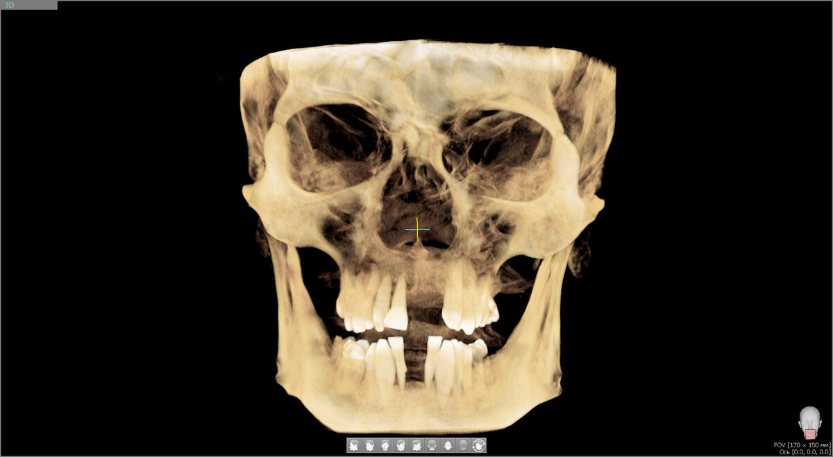 3Д КТ в виде, понятном для широкой аудитории.