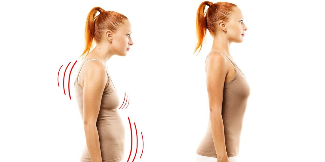 Как убрать сутулость?! Есть решение!