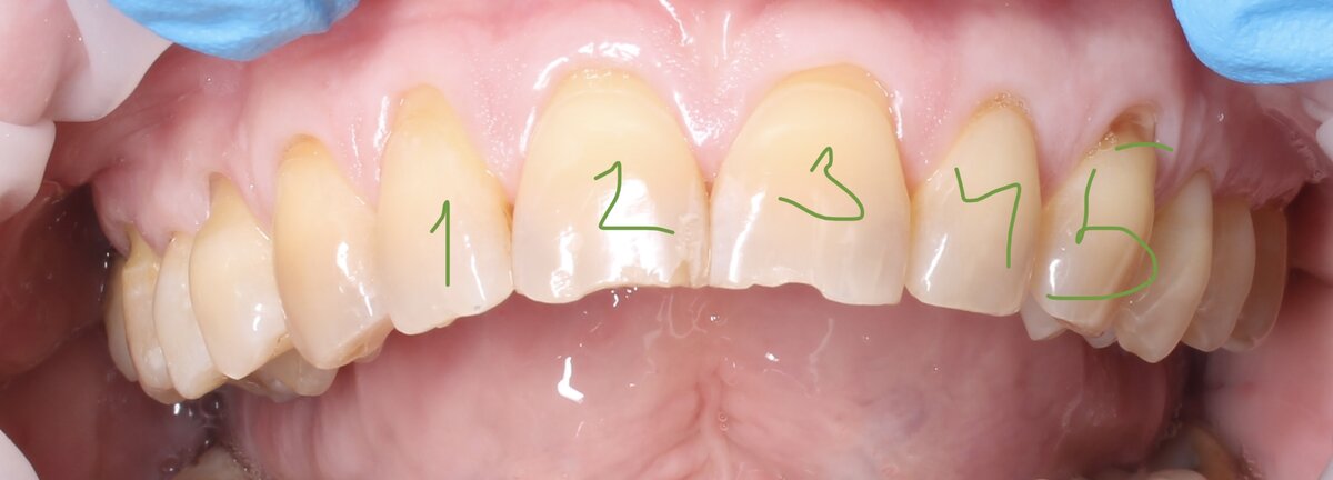 То, что хотели закрыть ортопед с пациенткой. 