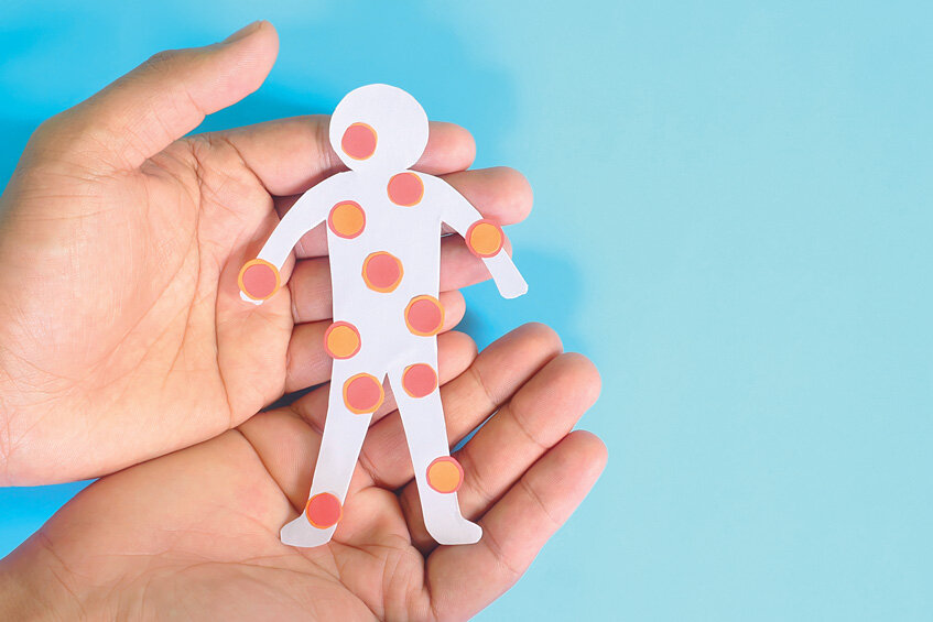 Корь: и снова здравствуйте!