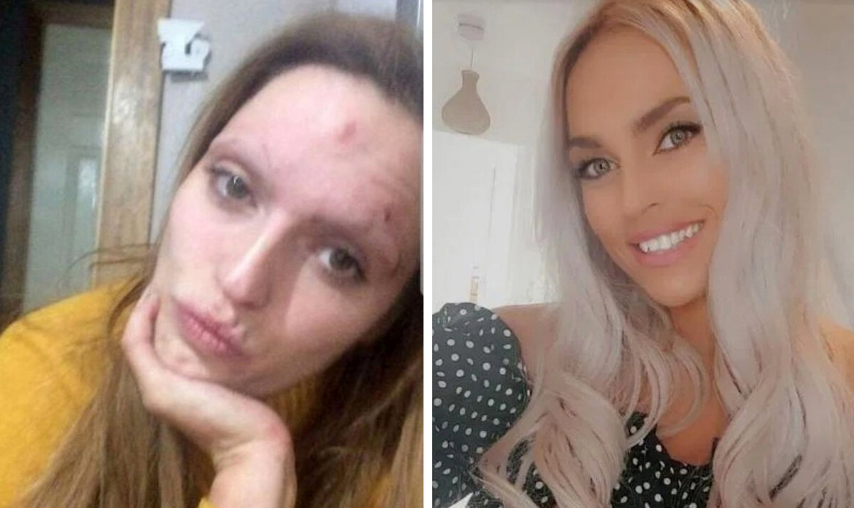 Как влияет алкоголь на внешний вид и поведение человека? | АНО ЦСА ...