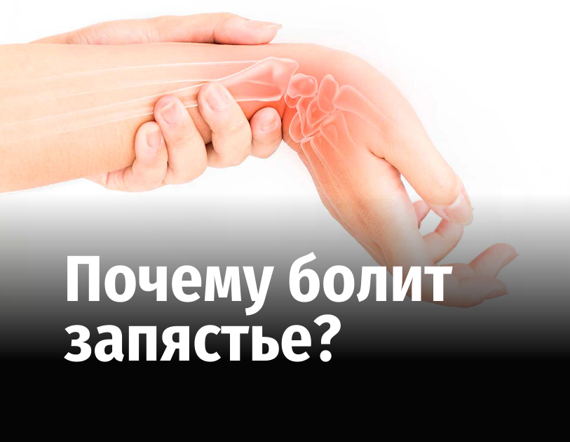 Синдром де кервена