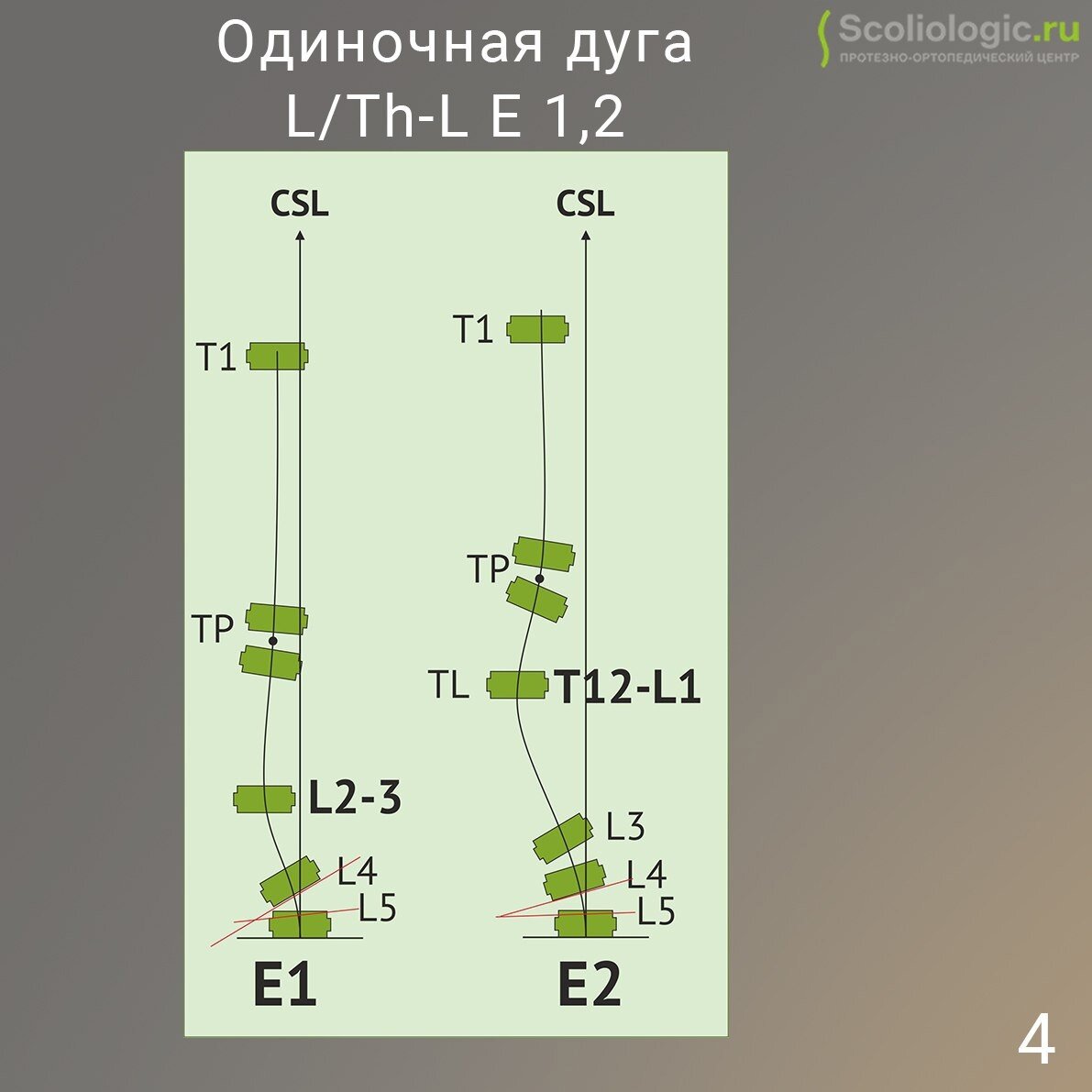 Сколиолоджик