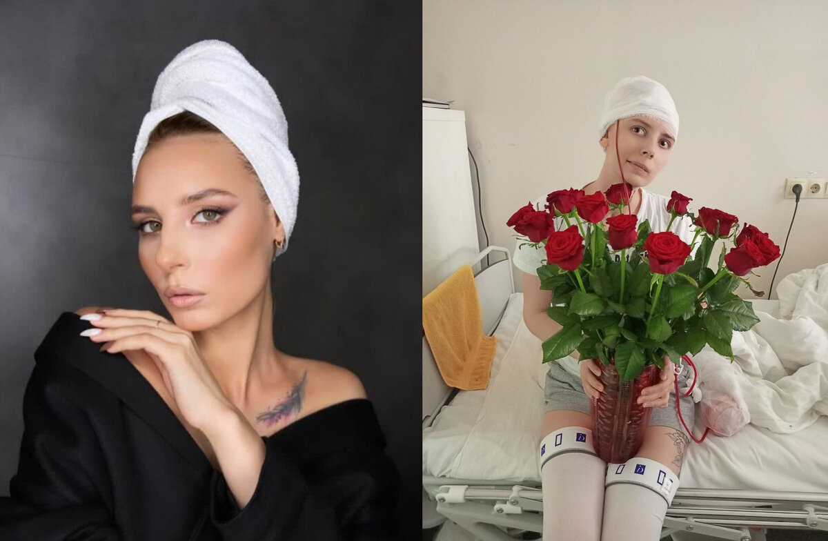 «Снова будет красивая девушка». Нейрохирурги прооперировали молодую ...