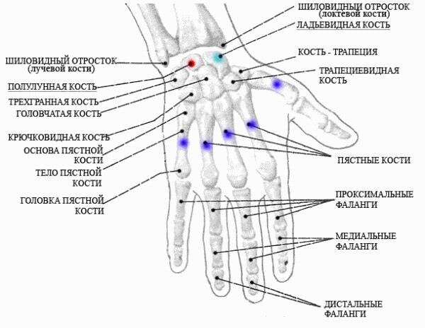 Болят лучевые кости почему