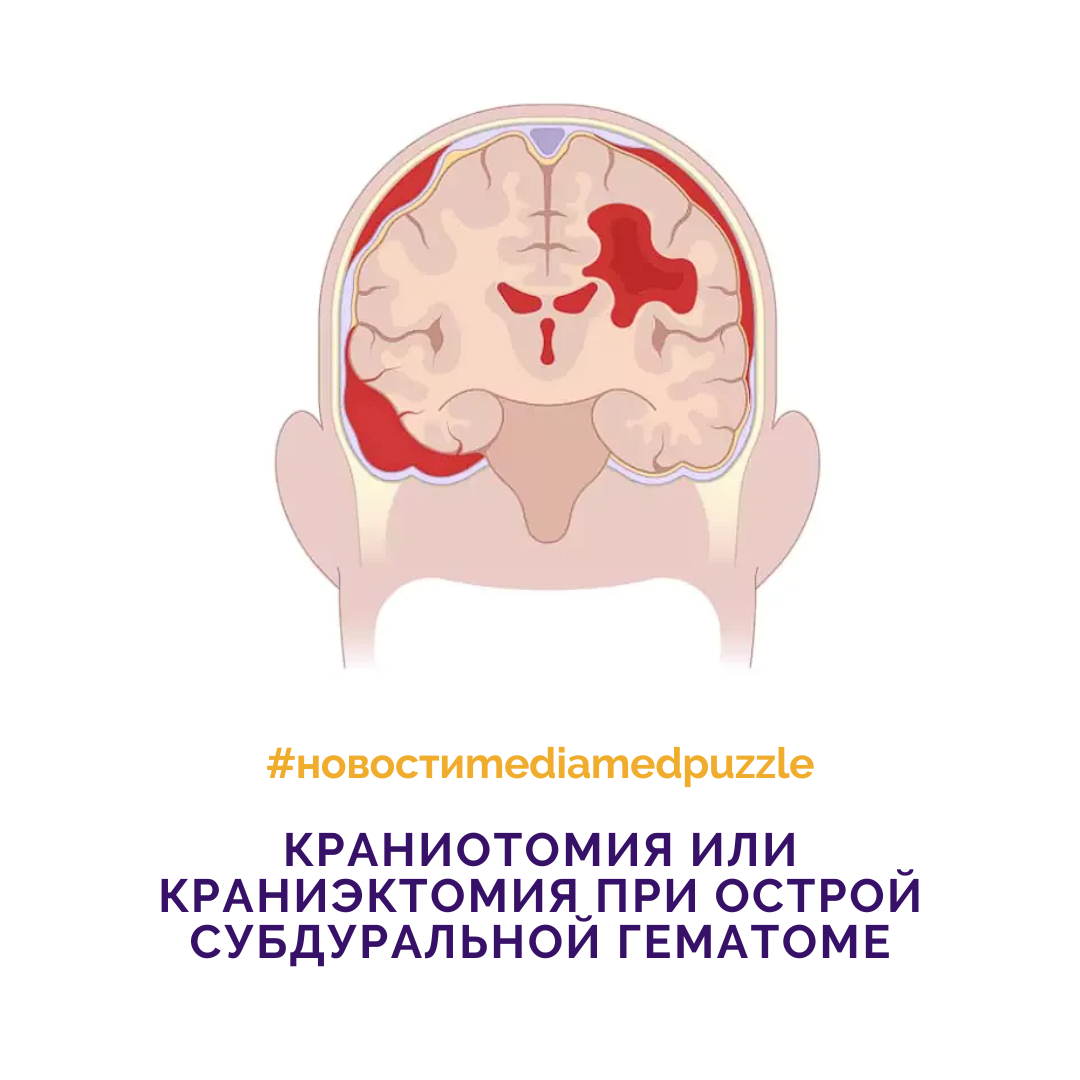 Острая субдуральная гематома клиническая картина