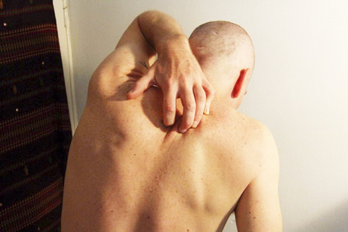    В Красноярском крае более чем в 2 раза увеличилась заболеваемость чесоткой